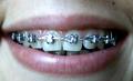 Snapshot_20110822_6.JPG