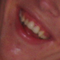 Biezymiannyi1.png