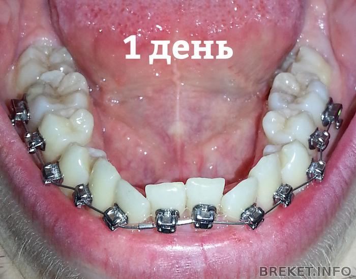 НЧ 1 день