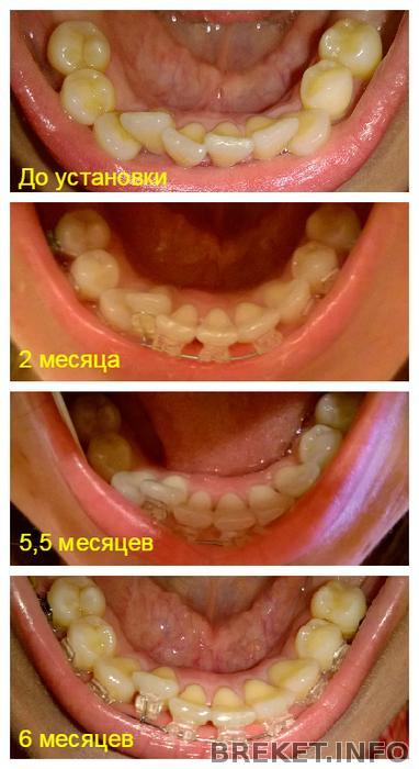 НЧ за 6 месяцев.jpg