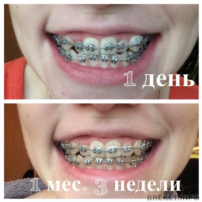 4 посещение. Вид спереди.