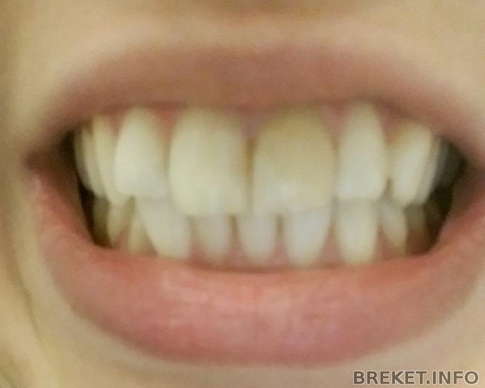 20150627_1526345.jpg