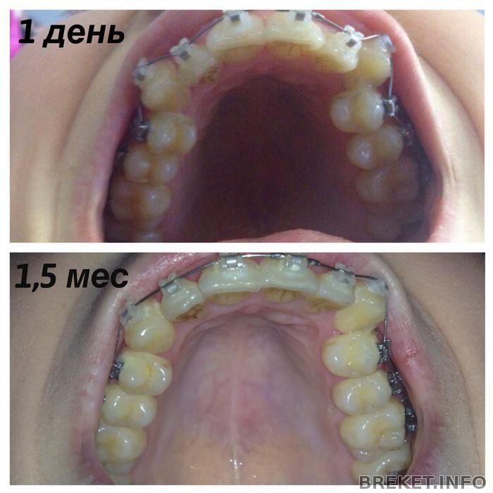 1 день- 1,5 мес