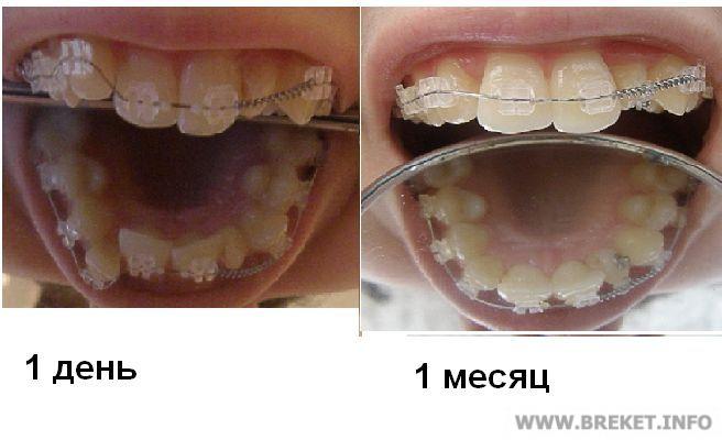 мои первые результаты