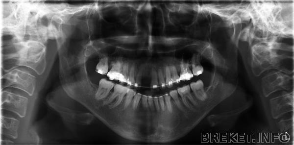 ortho_15_11_11.jpg