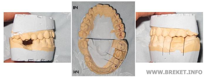 вид справа; обе челюсти; слева