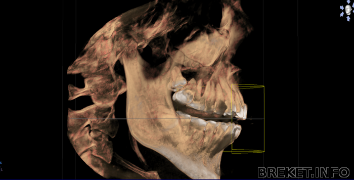 Скриншот 3D-КТ (4)