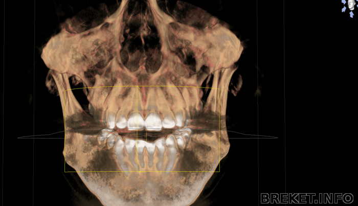 Скриншот 3D-КТ (6)