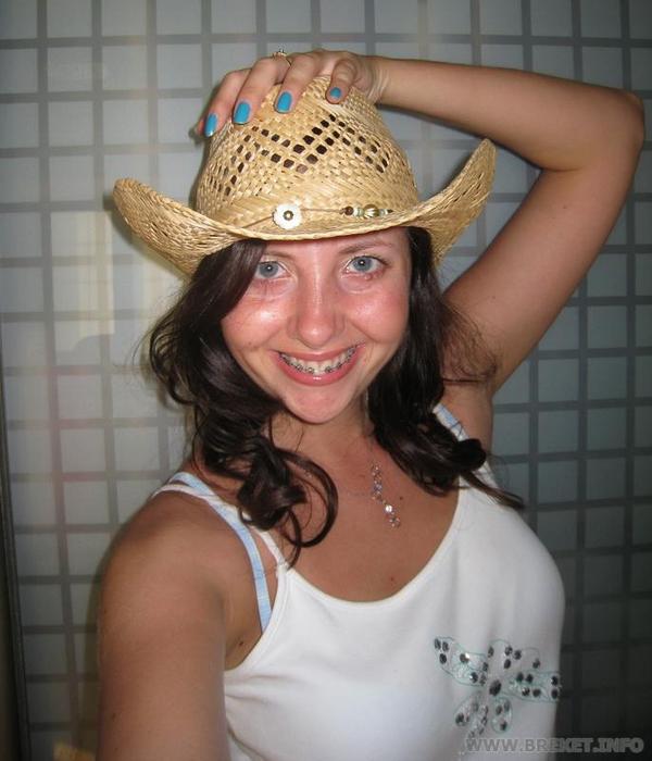 cowgirl and her braces