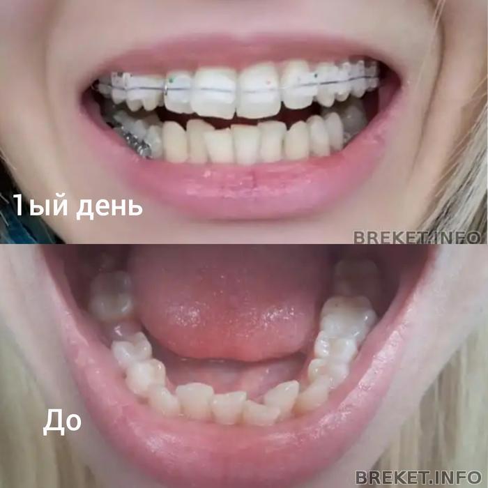 collagemaker_20190125_231717150.jpg