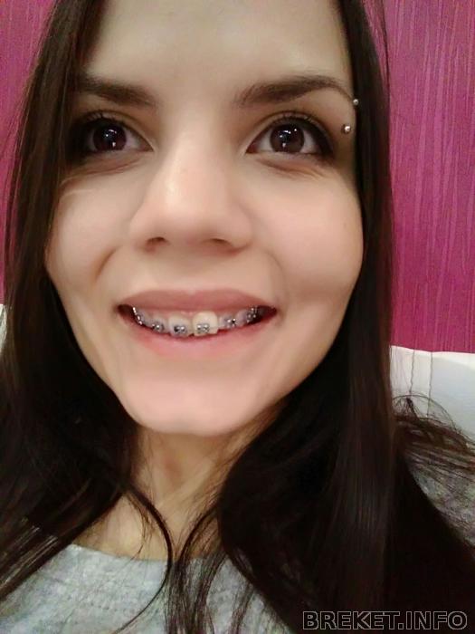 p_20180306_191559_1_bf_p.jpg