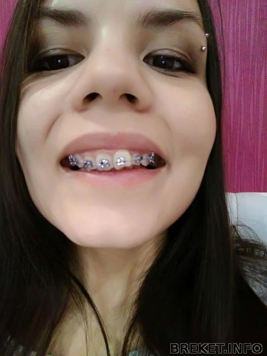 p_20180306_191528_1_bf_p.jpg