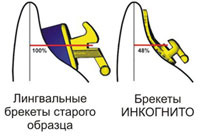 инкогнито.jpg