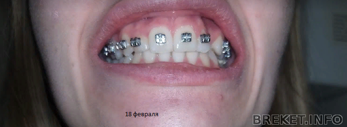 18_fevralya_2020_perekos_2.png