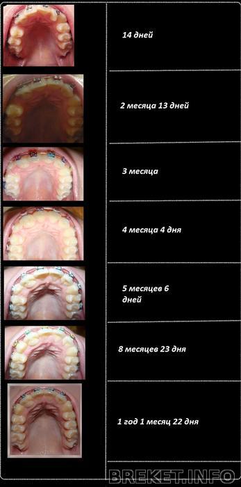 ВЧ вся история (коллаж)