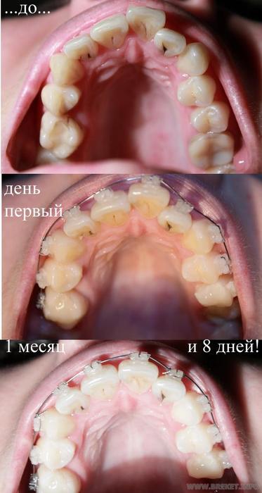 прогресс