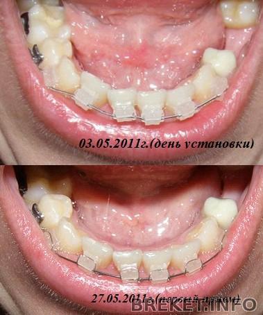 3_i_27_maia_2011gh._NCh.jpg