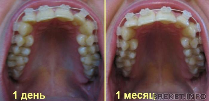 11.05_vs_11.06.JPG