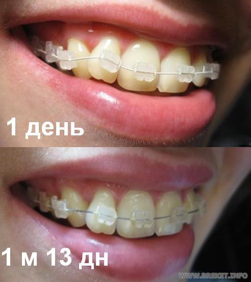 1 день vs 1,5 месяца