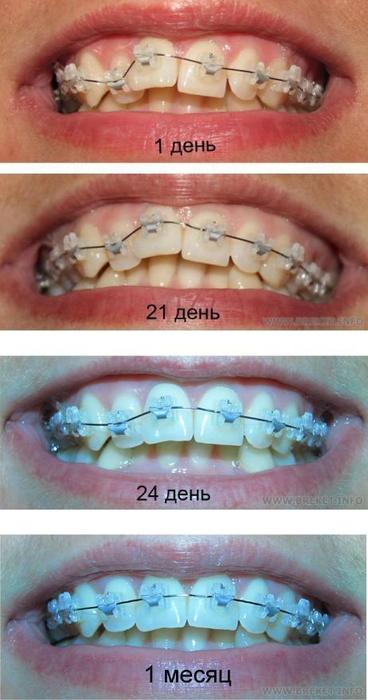 Вот уже прошла 1/18 часть времени, которое мне пророчит орт))