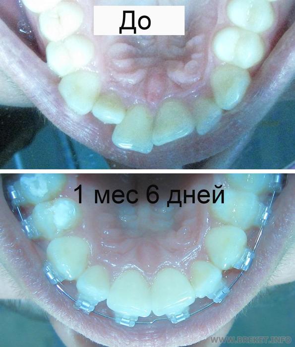 Сравнение 1 мес 6 дней