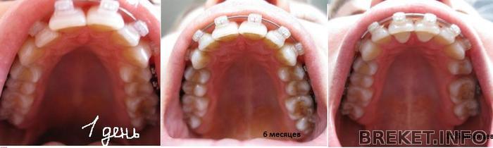 vch_sravn_1d_6m_12_m.jpg