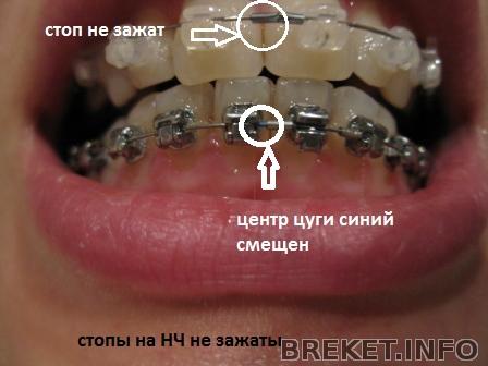 nch_14_kr_duga_1_den.jpg