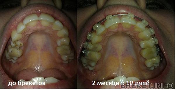 2_mesyaca_i_10_dney.jpg