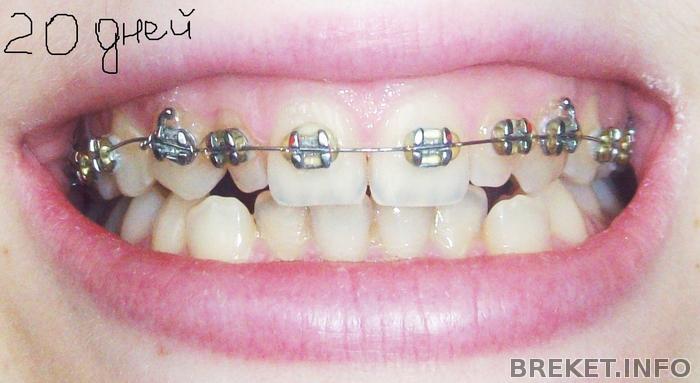 101_0093.jpg
