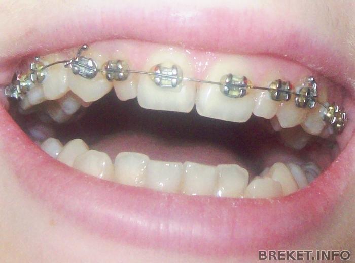 101_0095.jpg