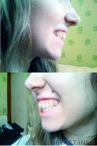 vid-so-storony.jpg