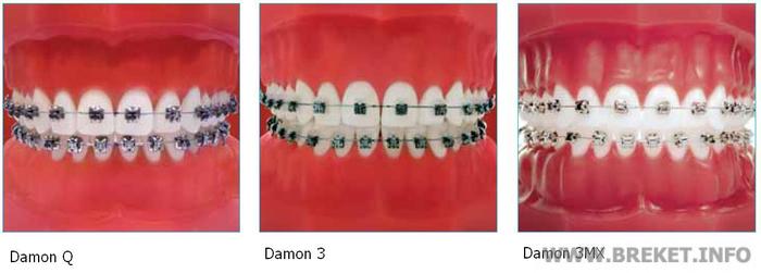 Damon Q, Damon 3, Damon 3MX