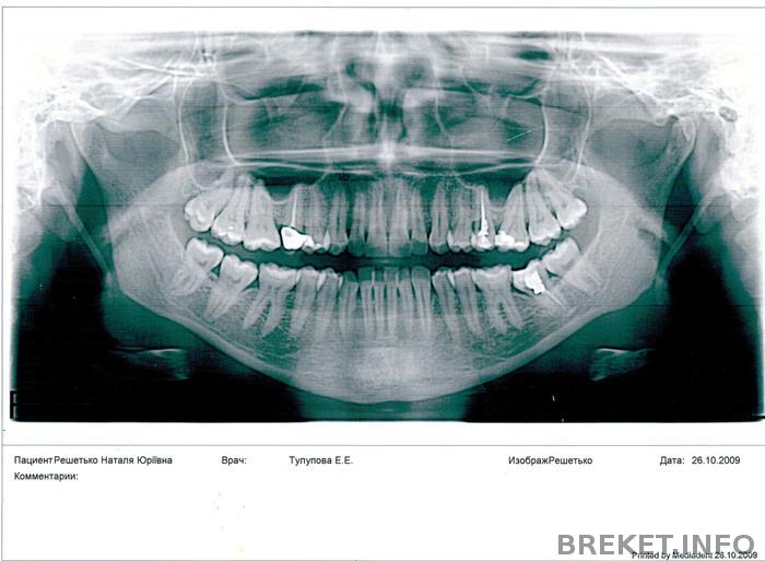 Ортопантомограмма.jpg