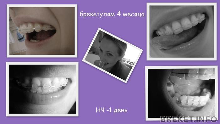 4 месяца-