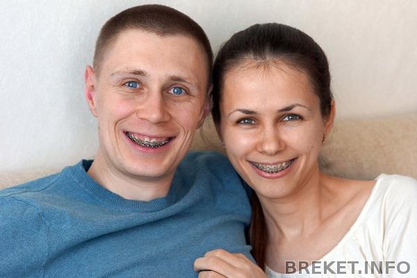 Два брекетоносца. 2 года спустя :-)