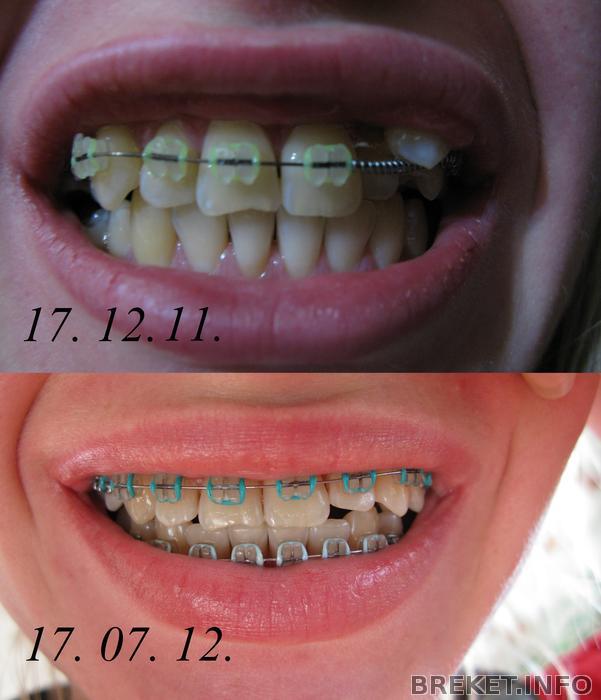 1-8месяцев progress.jpg