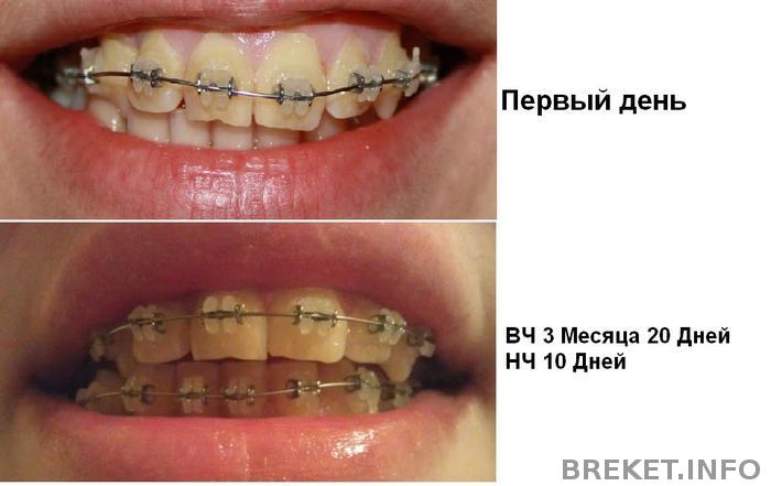 зубрики, сравнение, оч хочется услышать ваше мнение