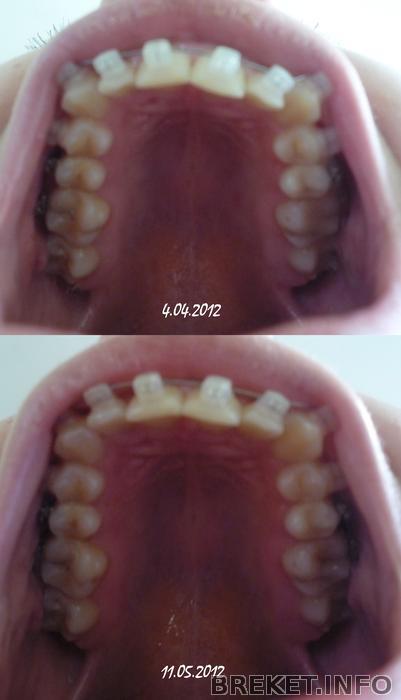 pervyy_progress_1_mes.7_dney.jpg