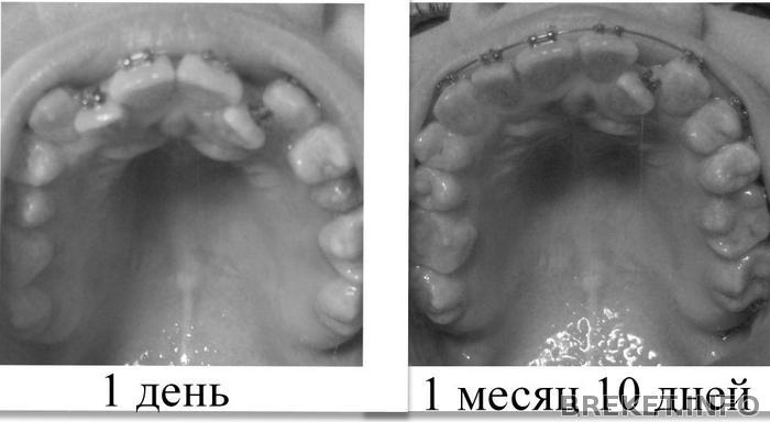 kollazh_1_mesyac_10_dney.jpg