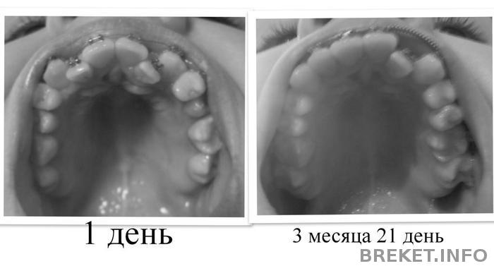 3_mesyaca_21_den.jpg