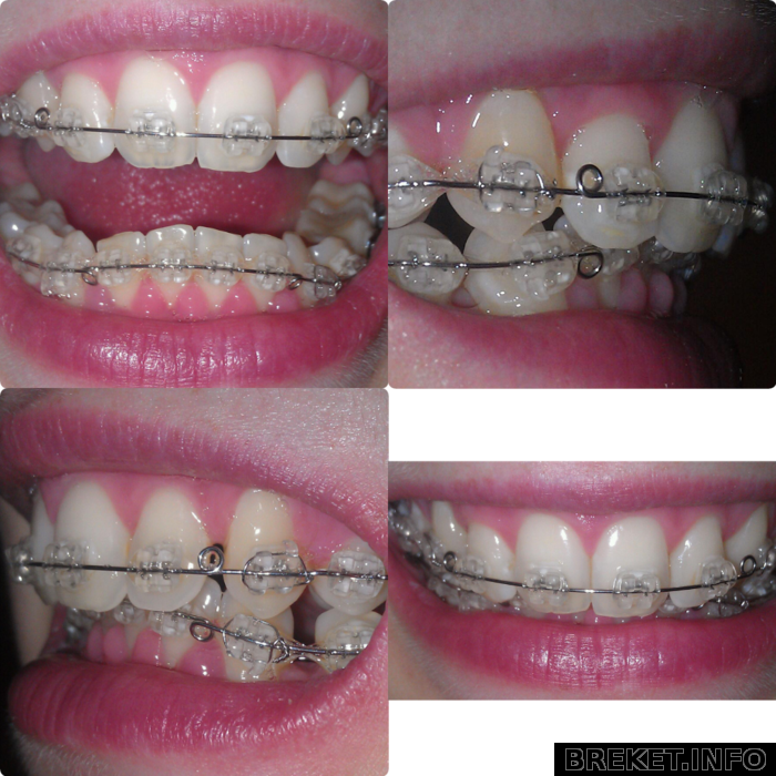 photogrid_1366620375706.png
