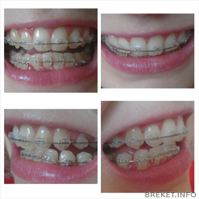 photogrid_1394691632132.jpg