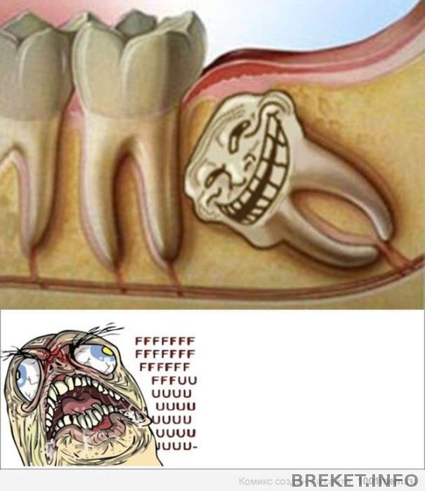 ретенированый и дистопированый зуб мудрости