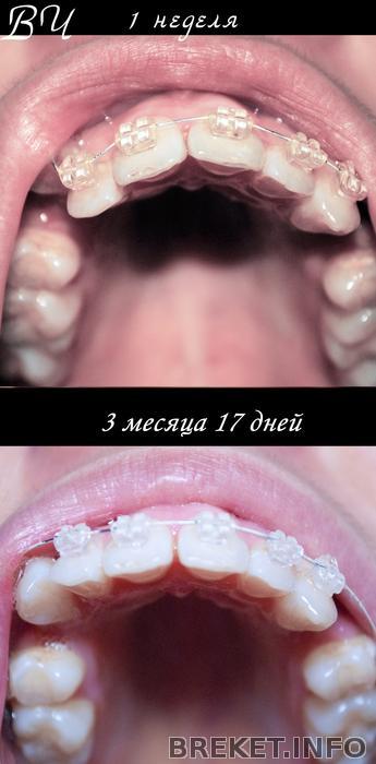 sravnenie_vch_ot_nachala_do_317.jpg