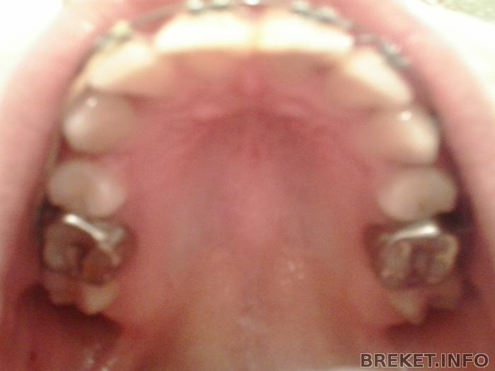 2012-12-17_01.11.46.jpg