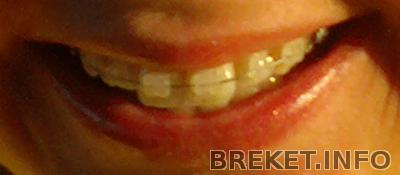 Улыбочку))))))