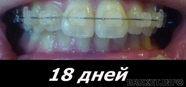 18 дней )