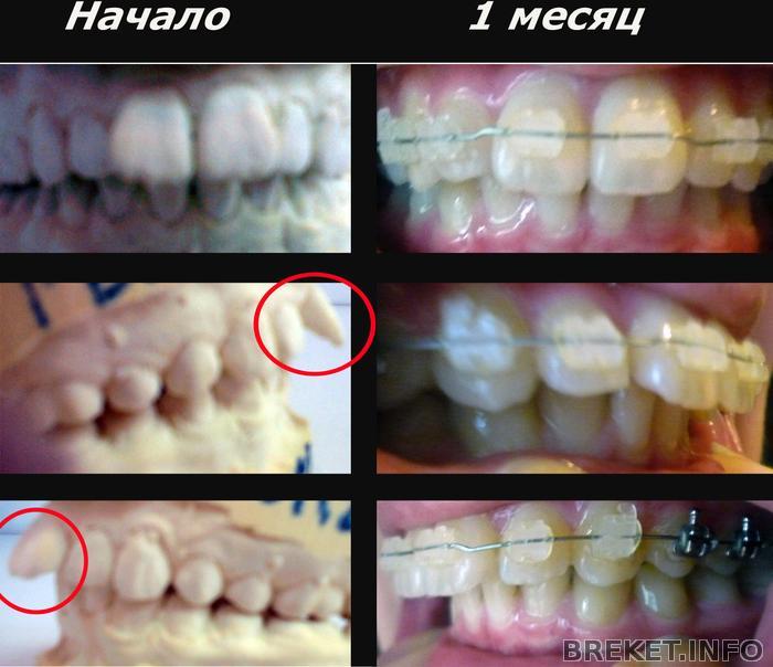 rezultat_mesyac_kopiya.jpg Результат 1 месяц