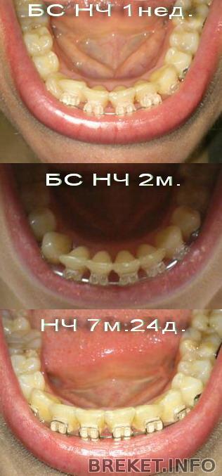 nch_7_mes_24_dn.jpg НЧ 7м.24дн