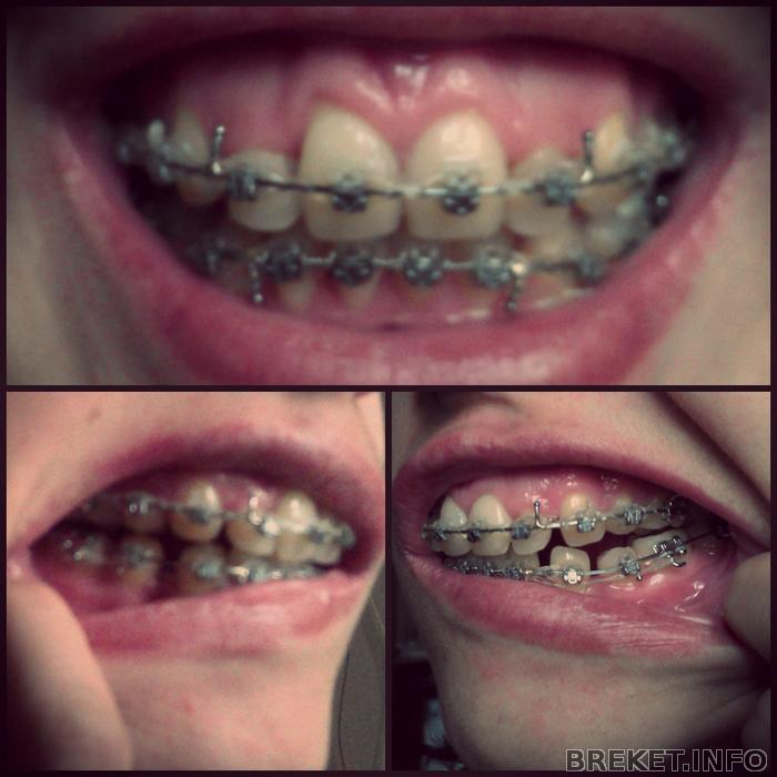 collage_10_mes._20_dn.jpg
